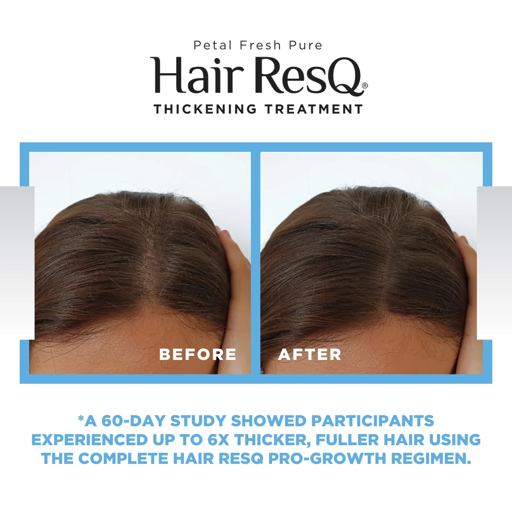 Petal Fresh Pure Hair ResQ Thickening Biotin Activation Pro-Growth Serum, 5oz