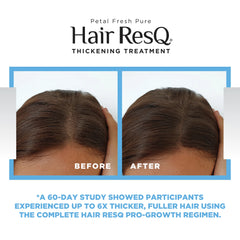 Petal Fresh Pure Hair ResQ Thickening Biotin Activation Pro-Growth Serum, 5oz
